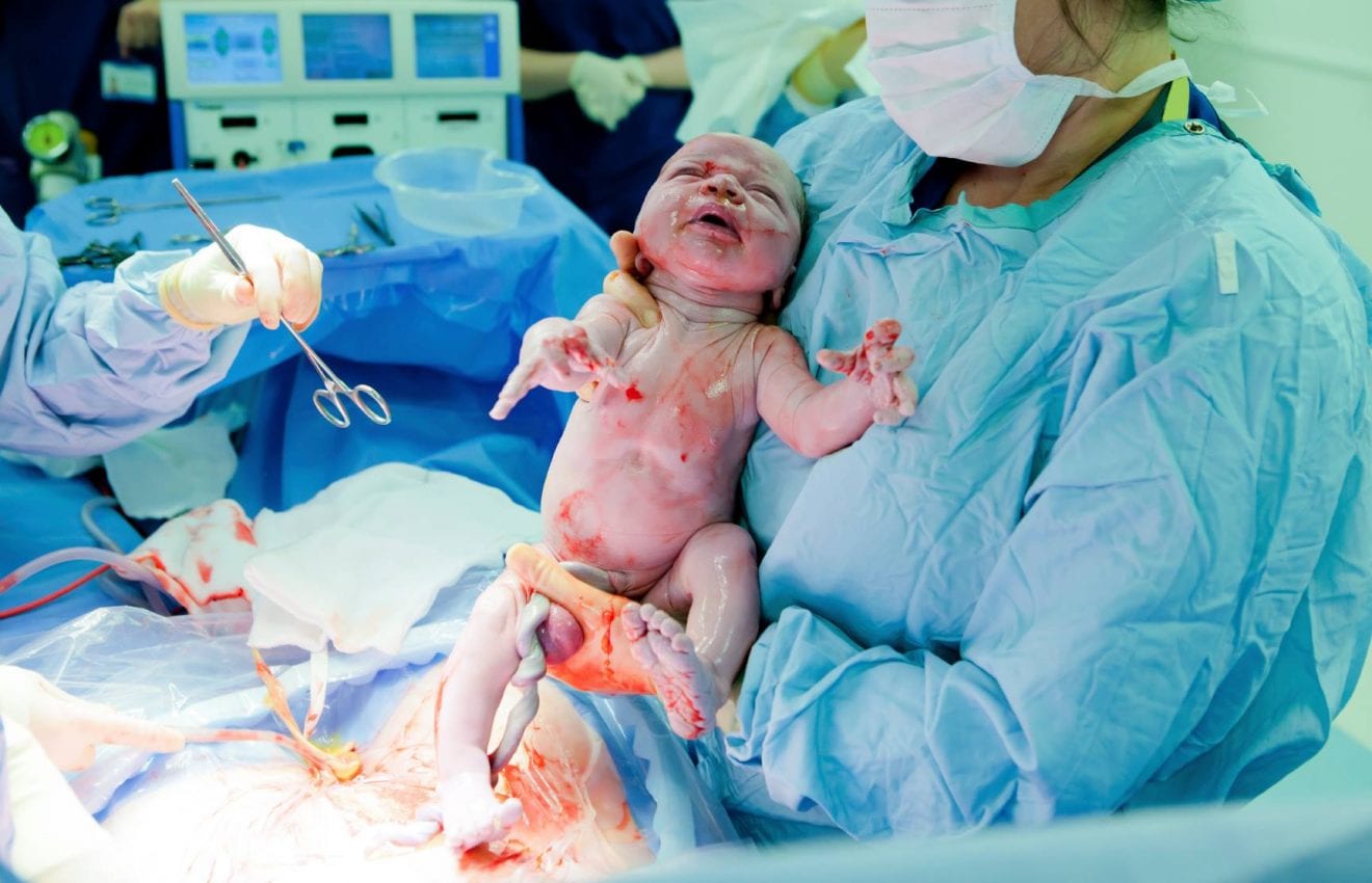 Why You Should Have a Birth Plan Even with a C-Section