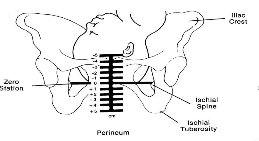 stages of station during pregnancy, cervical check