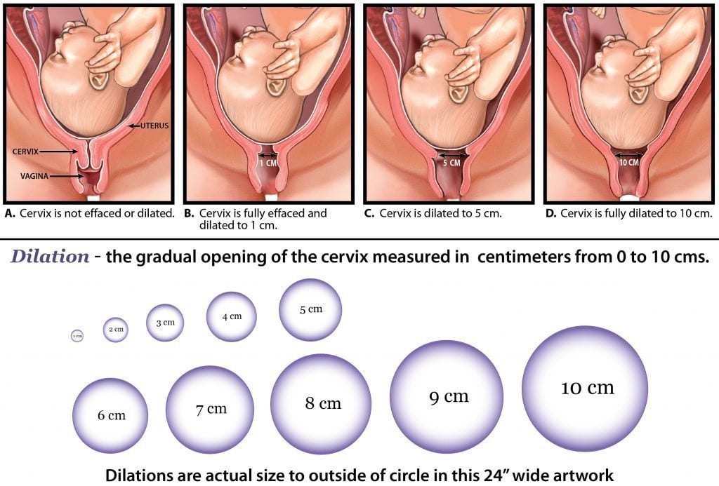 cervical dilation during pregnancy and labor