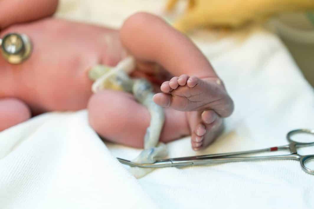 5 Benefits of Delayed Cord Clamping
