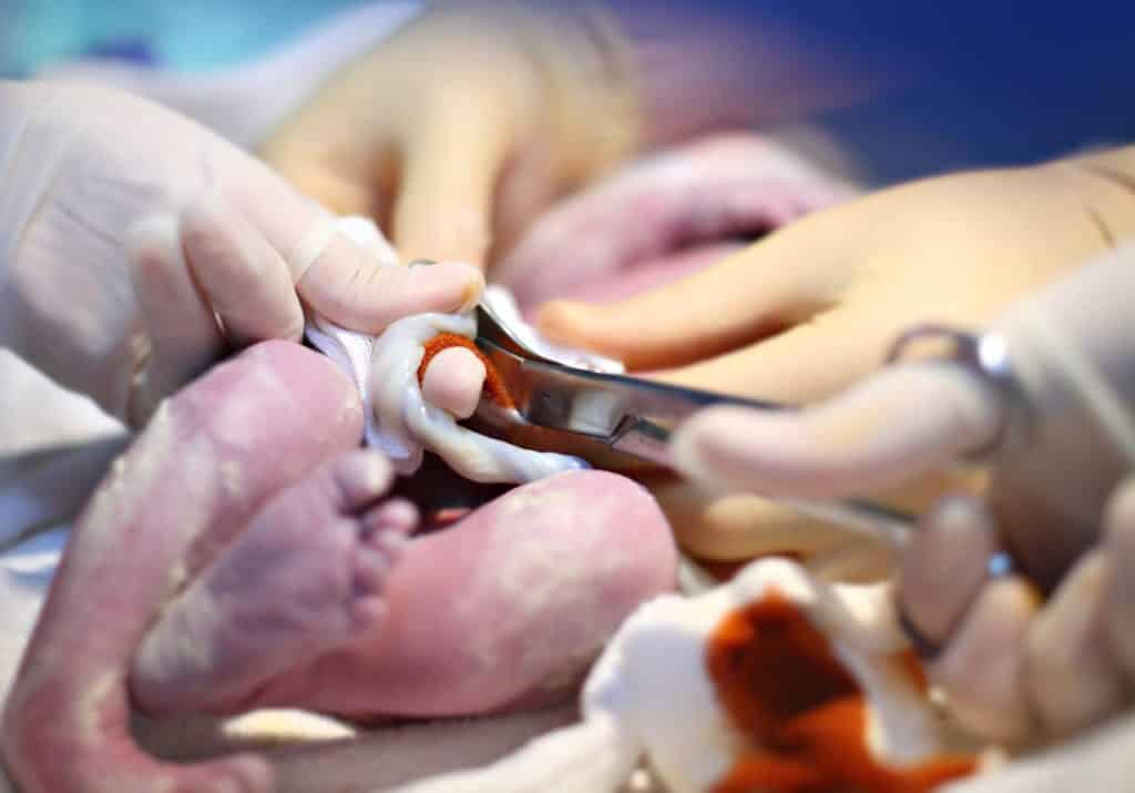 delayed cord clamping and cord blood banking