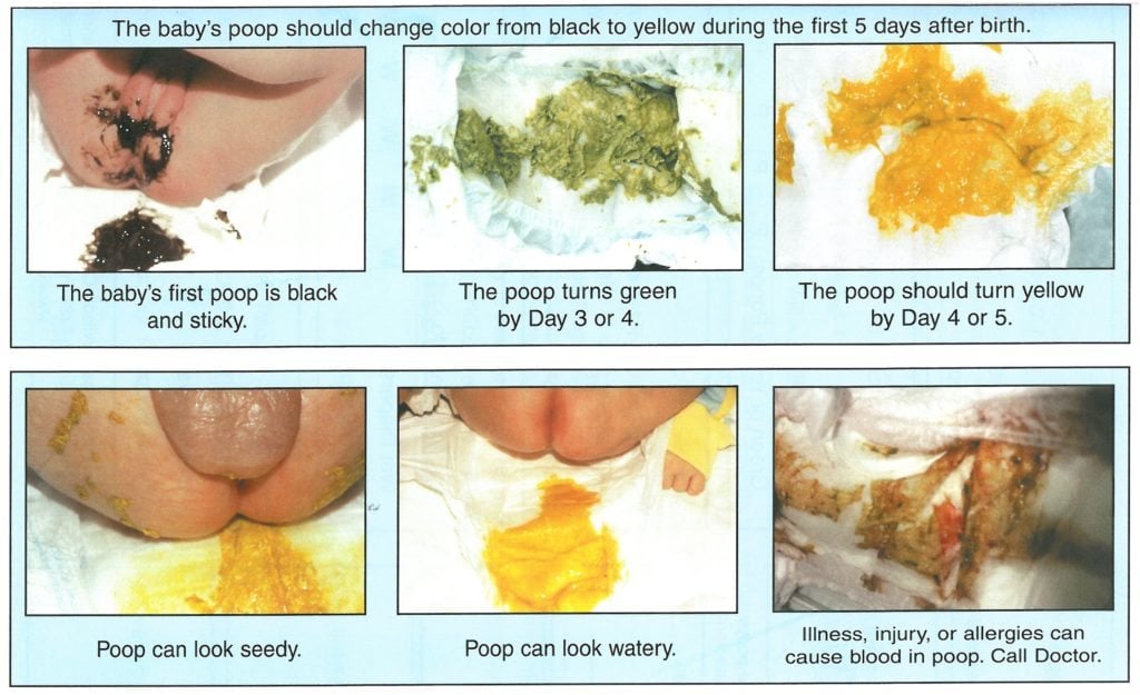 The 411 on All Things Baby Poop