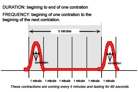 Labor contractions diagram