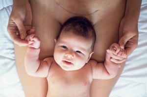 7 Tips for a Smooth C-Section Recovery