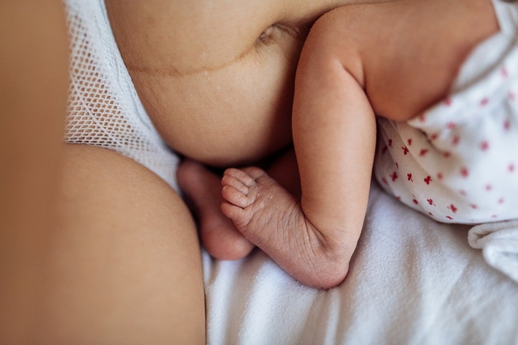 Millennial mother with visible postpartum body marks in bed with baby.