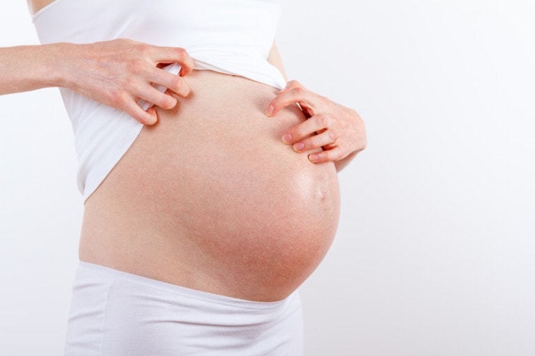 pregnant woman scratches itchy belly