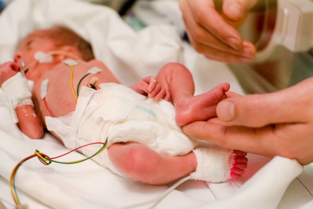 wired premature baby lies in the incubator and the dad's hand caresses the little foot