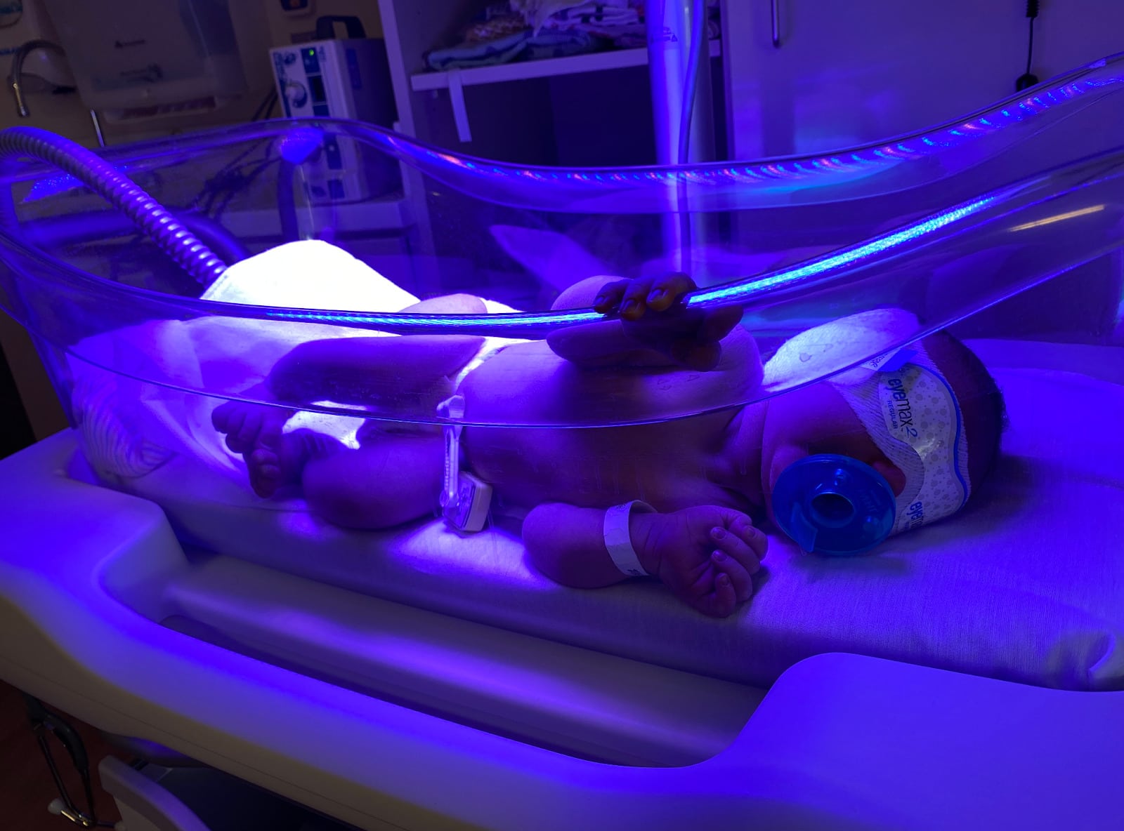 baby receiving phototherapy with blue lights and a bili blanket