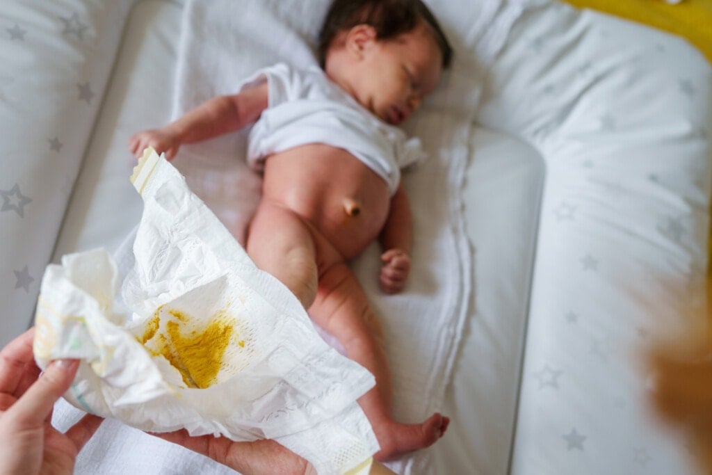 Close up on hand of unknown caucasian woman changing diapers with yellow poop in the dirty diaper.