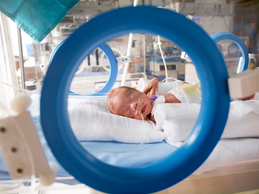 Baby girl born at 6th month of pregnancy, weighting only 650g at a time in NICU.