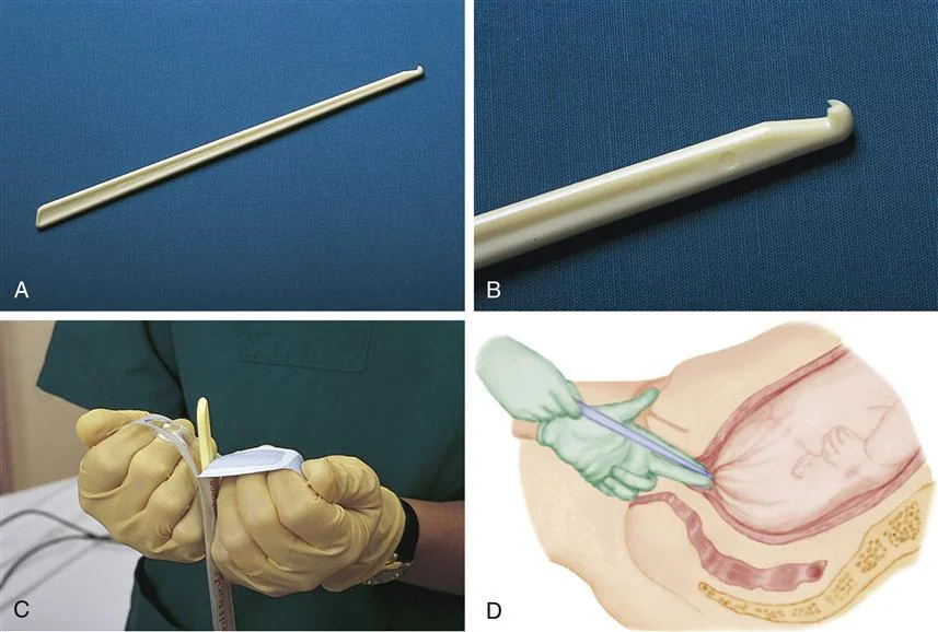 Arm Induction The Different Labor Induction Methods - Baby Chick