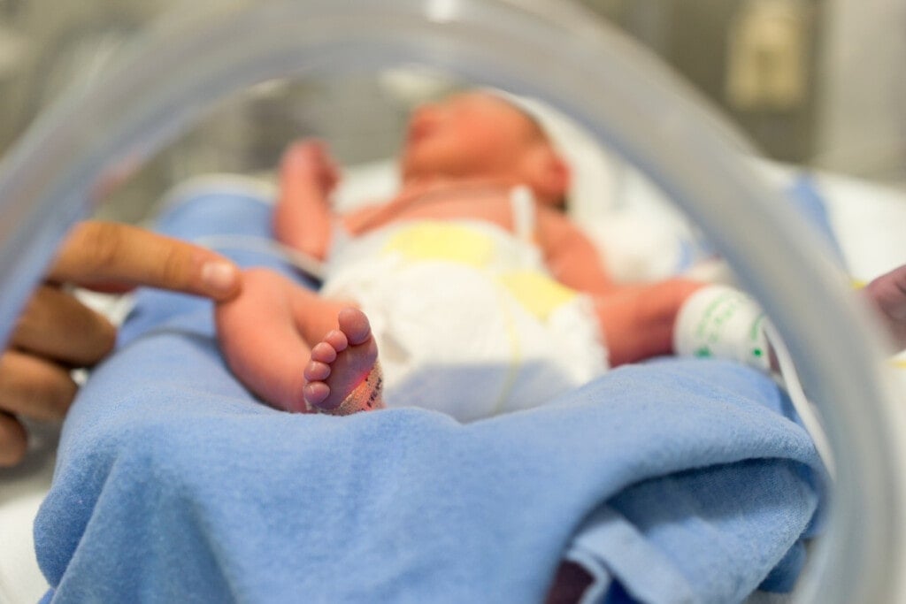 Photo of a premature baby in incubator. Focus is on his feet and toes. The doctor is touching him to check his reflexes. There are cables and tubes in the out-of-focus area.