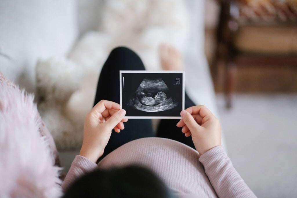 Young Asian pregnant woman lying on sofa at home, looking at the ultrasound scan photo of her baby.