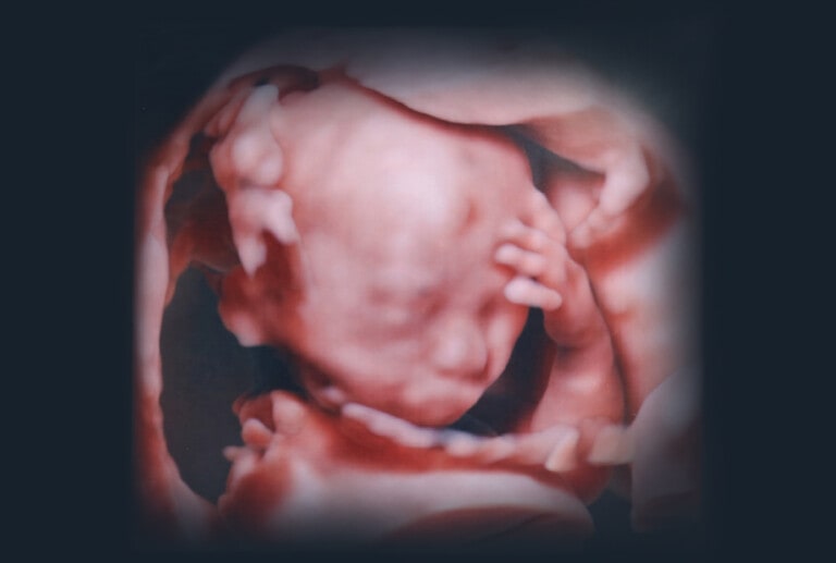 3D pictures of the fetus