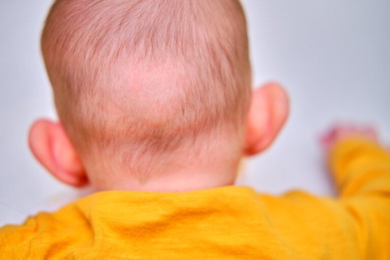 Bald spot on the back of the infant baby head.