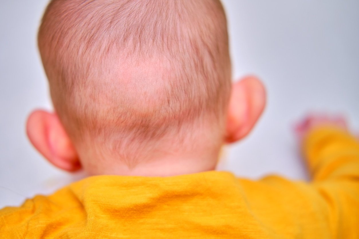 What could be causing hair loss in your child  Nation