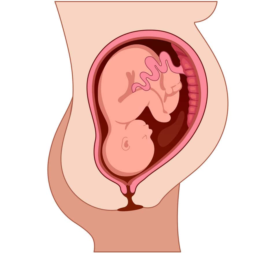 Fetus in Uterus during pregnancy. Pregnancy women anatomy. Fetus with umbilical cord and placenta. Colored medical vector illustration.
