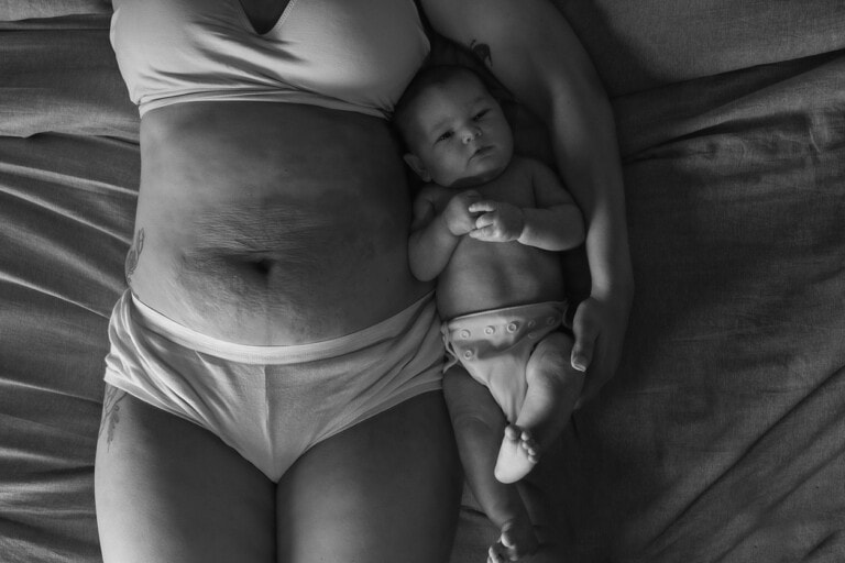 A baby lays next to his mothers stomach on a bed, she is in her underwear, her stomach is full of stitch marks and the sins of carrying a baby.