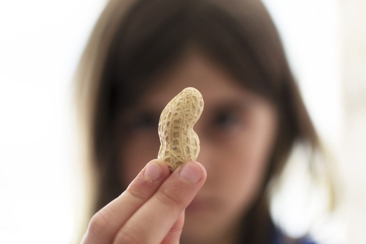 ‘Miếng đậu phộng’ có thể thay đổi cuộc sống của những đứa trẻ bị dị ứng
