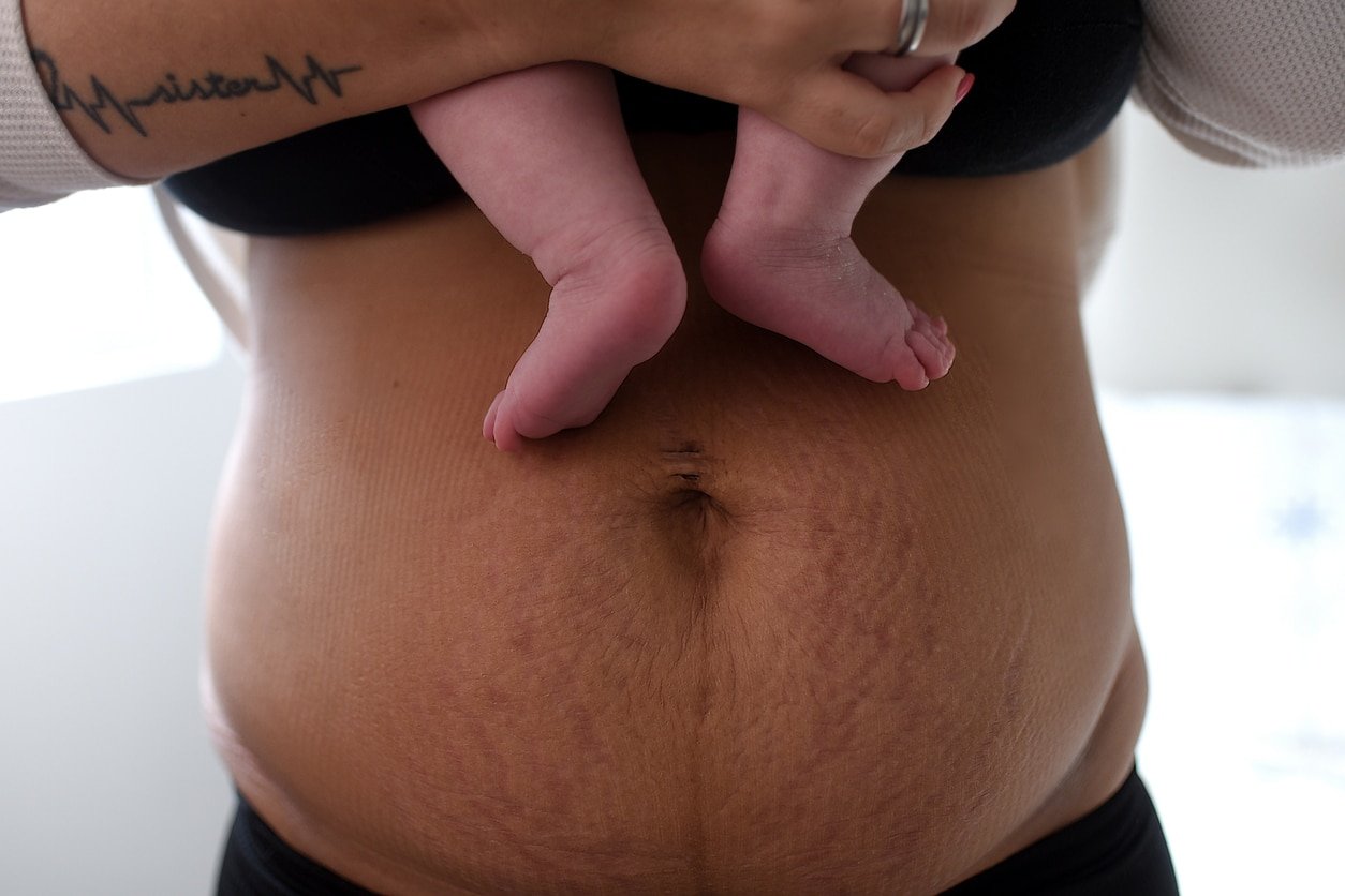 A cropped shot of a woman's postpartum belly with stretch marks and you can see her baby's feet that she is holding.