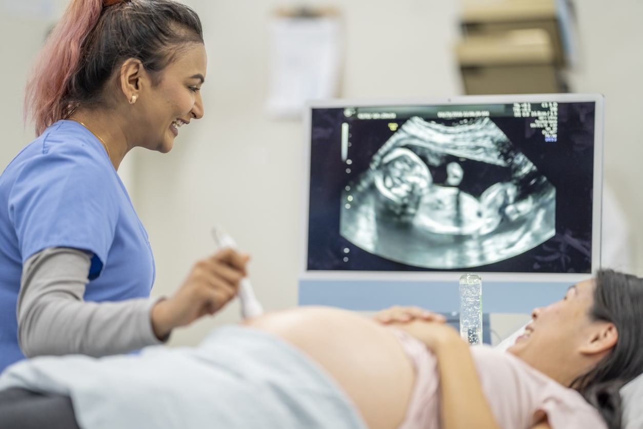 A pregnant female of Asian decent, lays out on an exam table as a technician conducts her ultrasound. She is dressed casually and has her belly exposed as she looks to the screen to see her baby.
