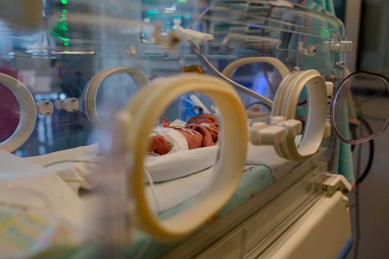 wired premature baby lies in the incubator