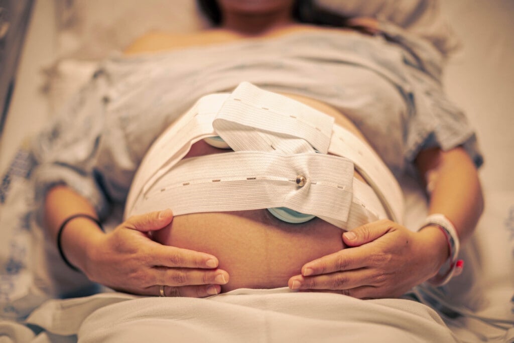 A pregnant woman in the hospital having contractions. Pregnancy cardiogram, fetal heartbeat.