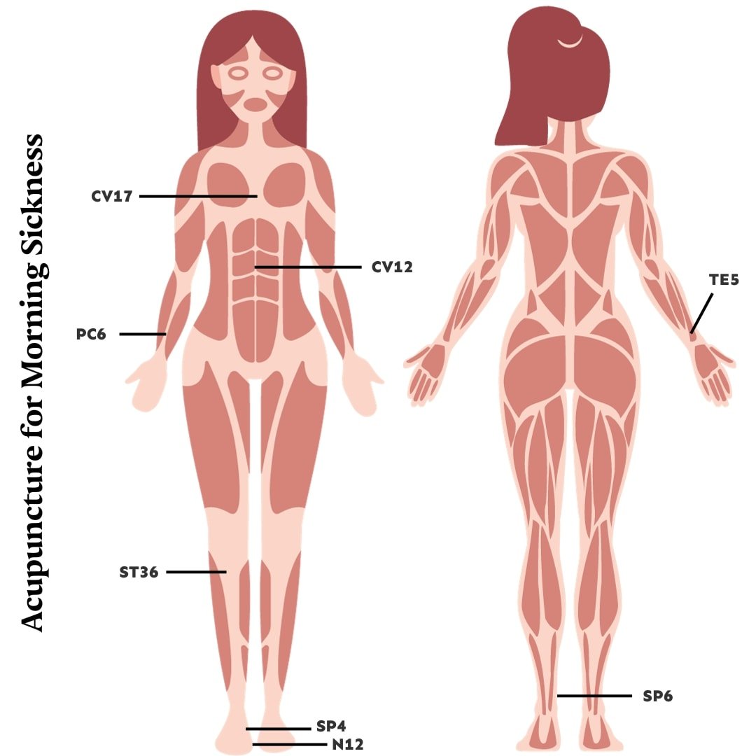 Graphic of acupuncture points during pregnancy for morning sickness