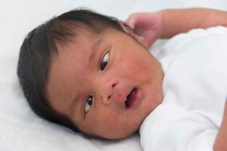 Cute newborn baby cross-eyed.