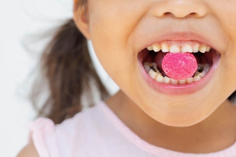 A little kid eating too much candy with teeth decay and yellow plack from bad oral care.